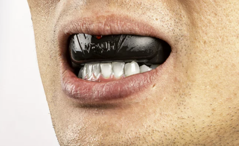 Venum Challenger Mouthguard: A Reliable Gear for Ultimate Protection